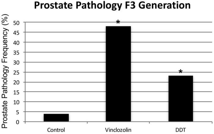 prostate pathology
