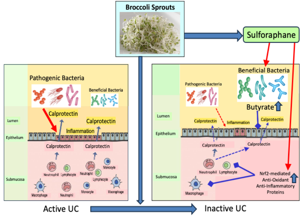 broccoli sprouts and ulcerative colitis